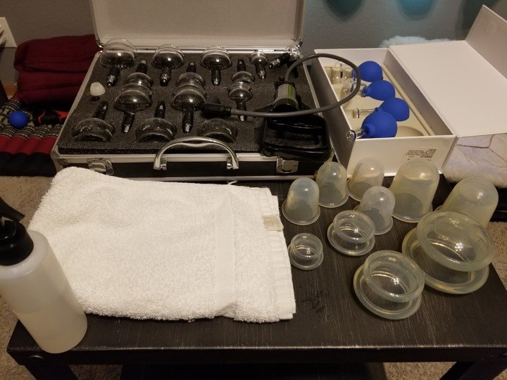 Cupping Therapy